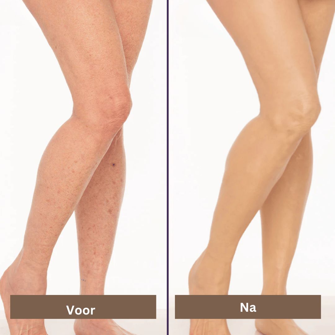 Før og efter billede af ben med hudforbedring; viser forskel i hudens udseende før og efter behandling. Hudpleje, skønhed, benpleje.